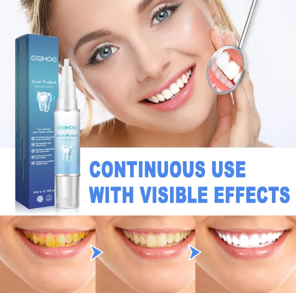 Gum repair gel tube and box beside a smiling woman
