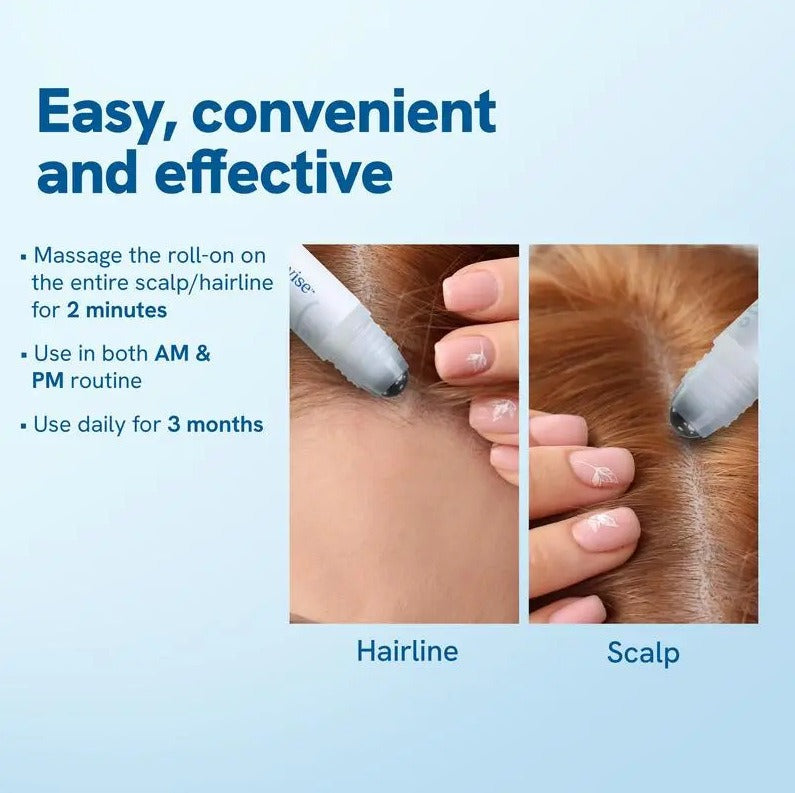 Hair growth serum roll-on bottle shown applying to scalp