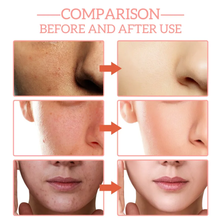 Before-and-after comparison of facial skin texture and tone in three stacked panels
