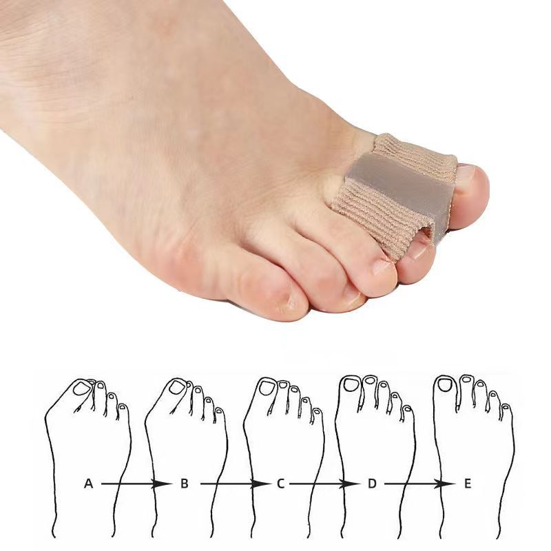 Fibre Toe Separator