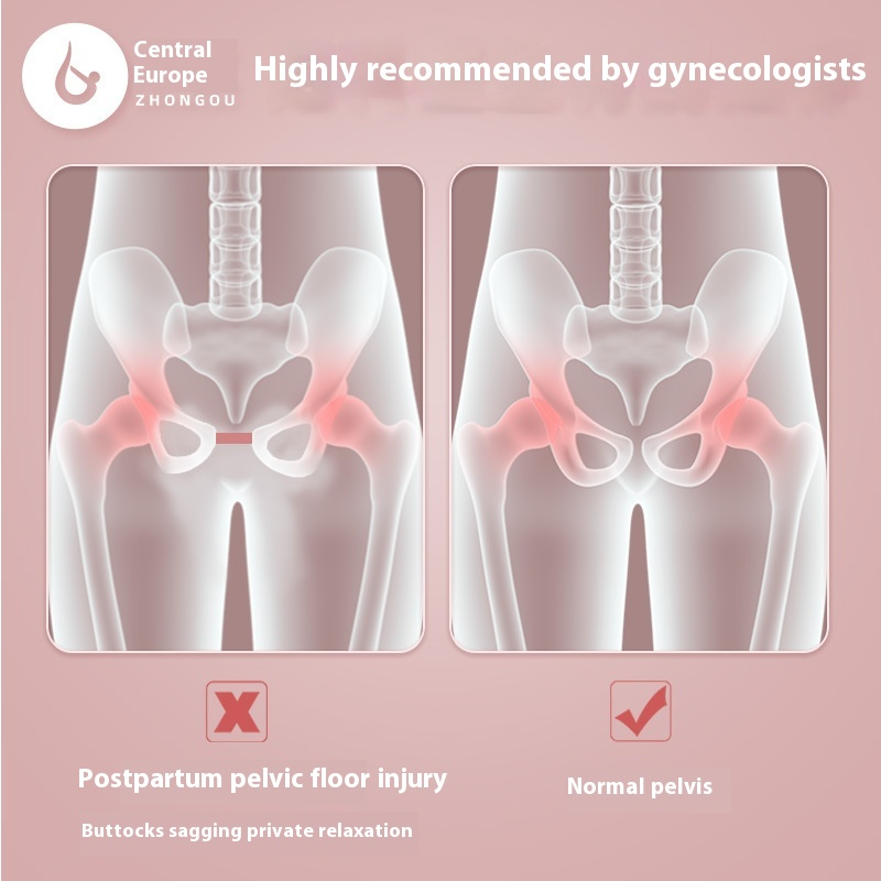 Pelvic floor injury comparison diagram with female pelvic silhouettes