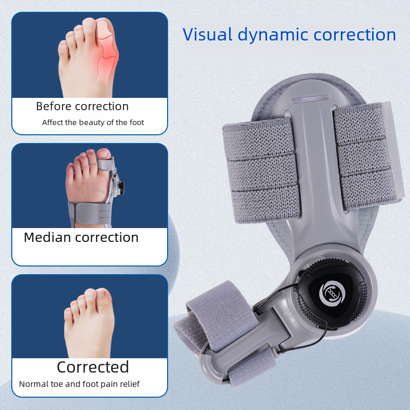 Gray bunion corrector brace with toe separator and circular adjustment knob, worn on foot