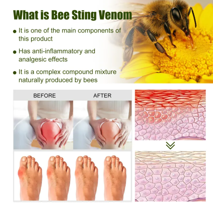 Infographic showing before/after foot pain and skin texture panels