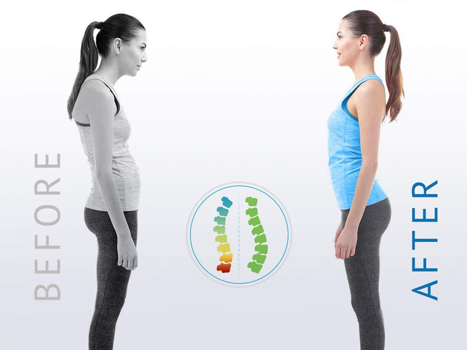 Posture corrector infographic with spine alignment diagram and before/after panels